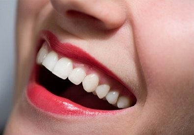 Cách làm răng trắng bóng với 5 công thức tự chế